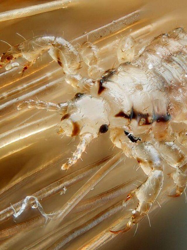 Home Remedies for Lice Removal
