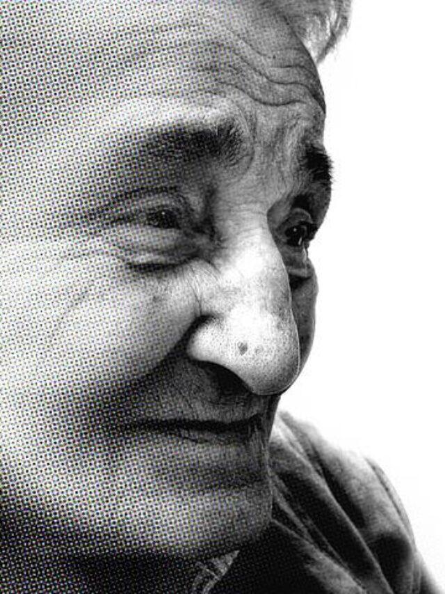 4 Causes of Alzheimer’s Disease